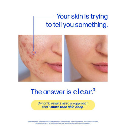 Clear³ Daily Skin Support – DIM + Probiotics + Zinc