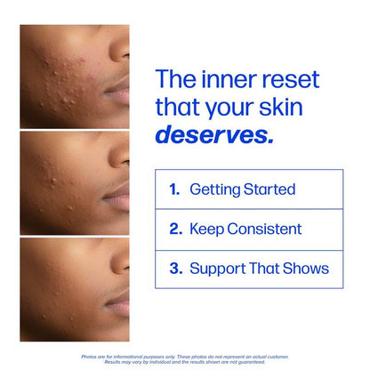 Clear³ Daily Skin Support – DIM + Probiotics + Zinc